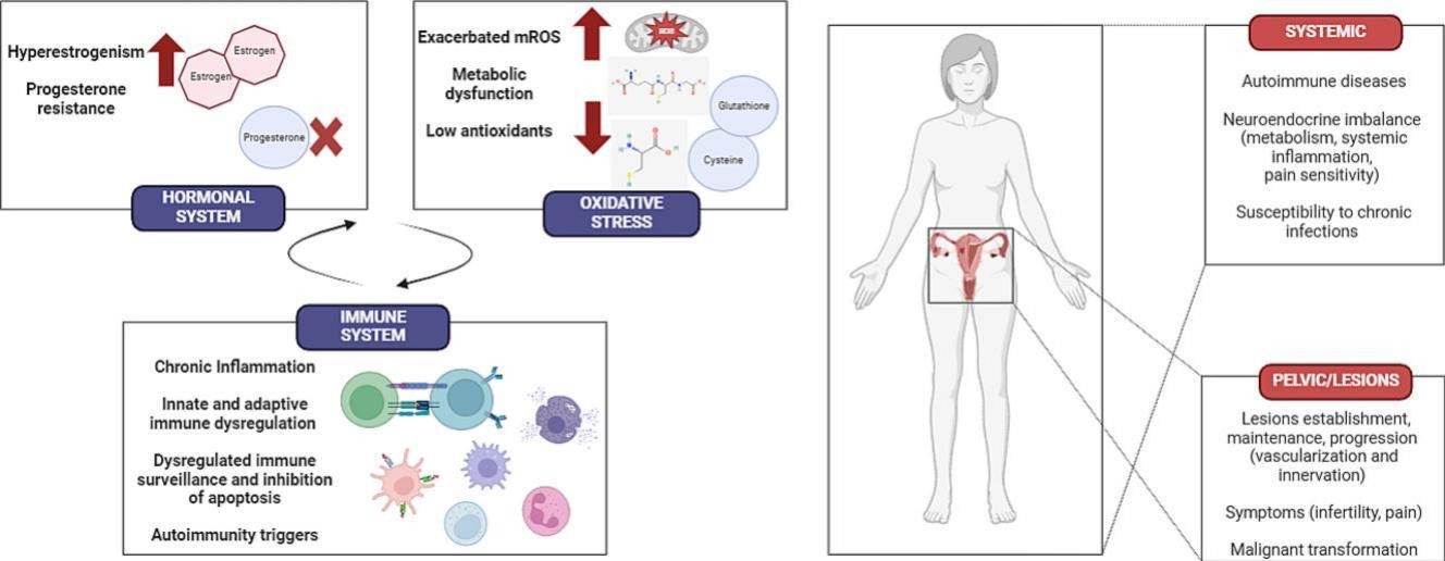 endometrioza